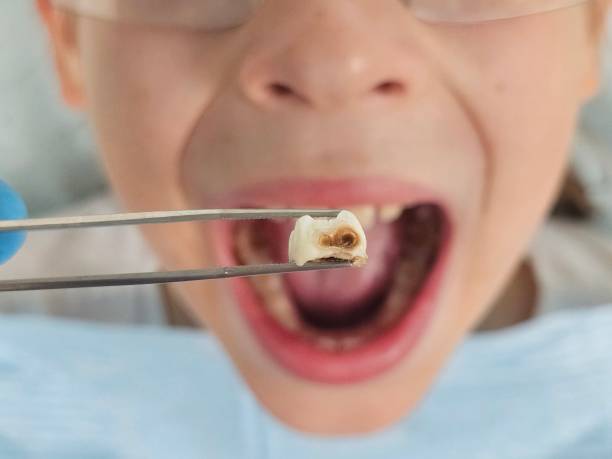 Best Emergency Orthodontic Repairs in Calhoun City, MS