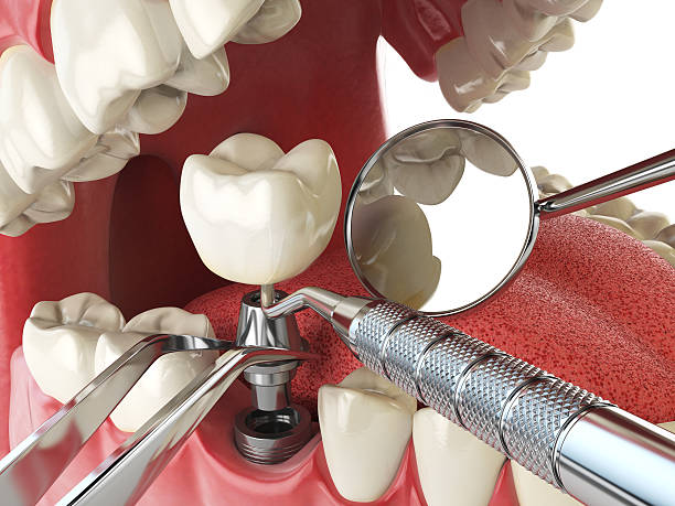 Best After-Hours Emergency Dentist in Calhoun City, MS