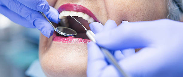 Best Emergency Tooth Extraction in Calhoun City, MS